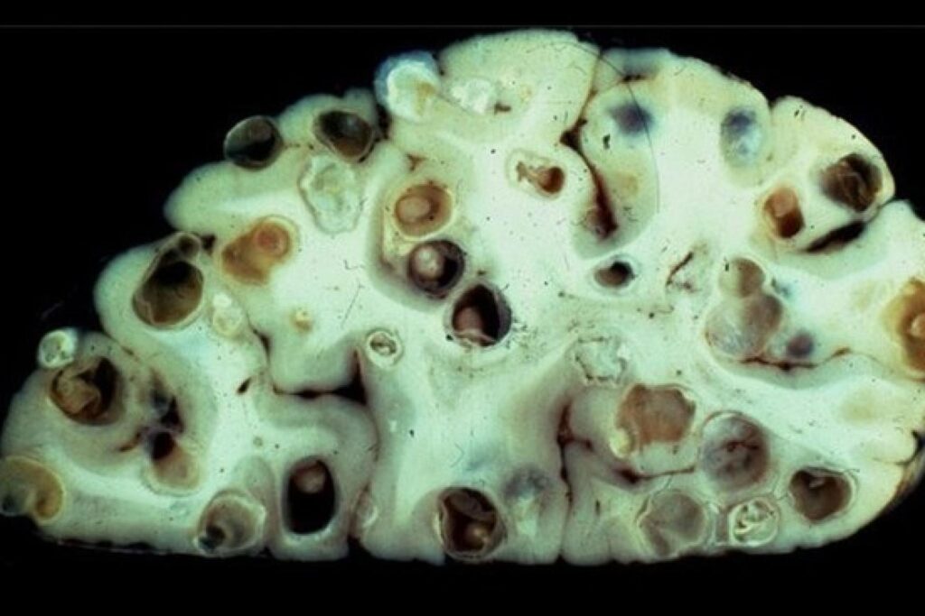 В США появилась амеба, которая поедает человеческий мозг В США появилась амеба которая поедает человеческий мозг