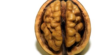 Ученые обнаружили зависимость размера мозга и интеллекта