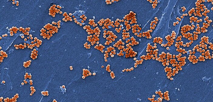 Медики создали гибридное антитело против "супербактерии"