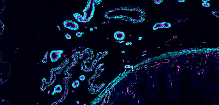 Ученые раскрыли, почему вирусные инфекции вызывают аутоиммунные заболевания