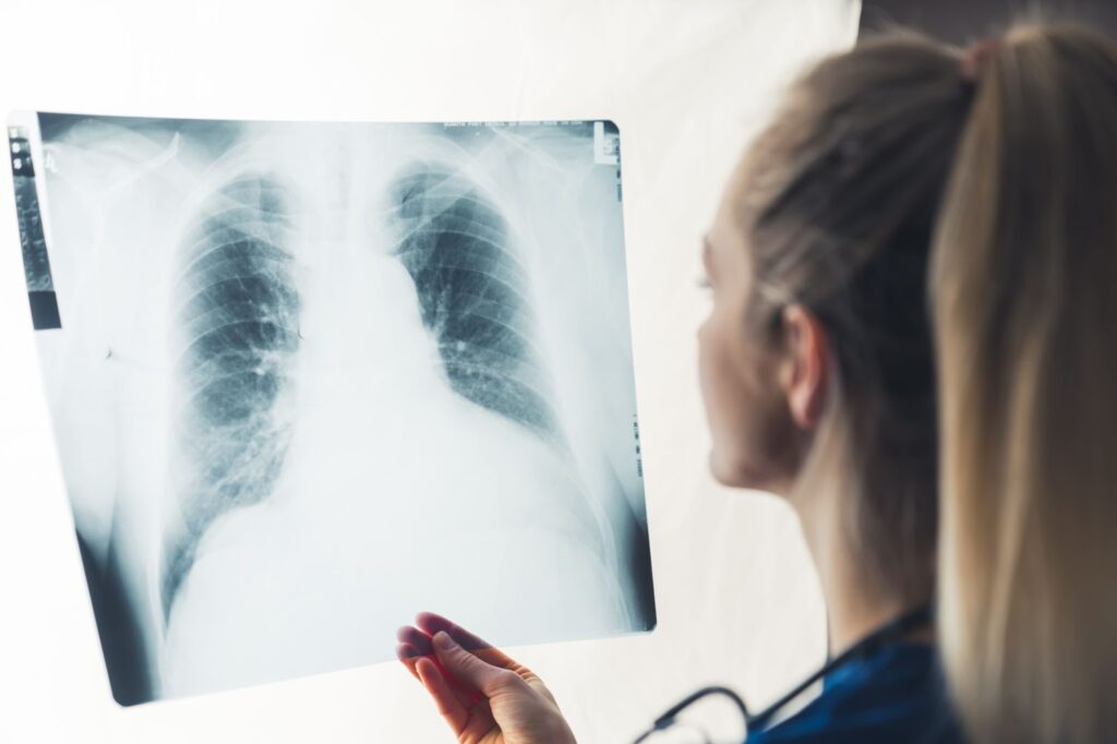 Ученые обнаружили свинец и никель в одноразовых вейпах