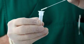 В России выявили 114 случаев нового штамма COVID-19 с необычным симптомом