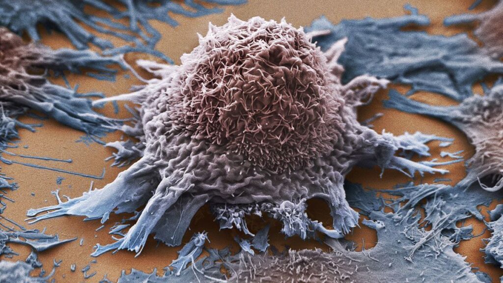 Прорыв в лечении рака: создана универсальная вакцина, убивающая любую опухоль