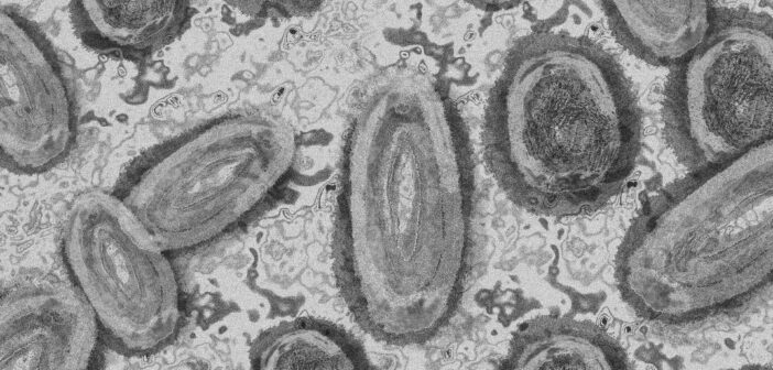 Вирус, вернувший карантин в Китае, теперь в России: зафиксирован первый случай