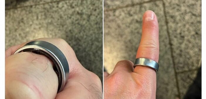 Кольцо Samsung чуть не лишило блогера пальца