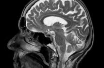 Ученые через ультразвук научились отключать тягу к курению