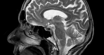 Ученые через ультразвук научились отключать тягу к курению