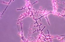 В Европе фиксируют взрывной рост супергрибка, устойчивого к лекарствам