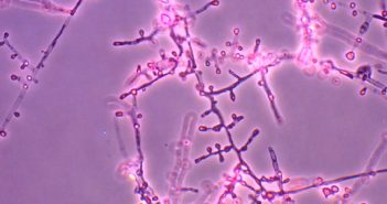 В Европе фиксируют взрывной рост супергрибка, устойчивого к лекарствам