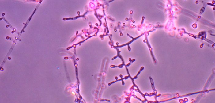 В Европе фиксируют взрывной рост супергрибка, устойчивого к лекарствам