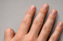 Верховный суд РФ запретил водить авто на механике без большого пальца