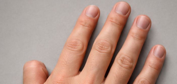 Верховный суд РФ запретил водить авто на механике без большого пальца