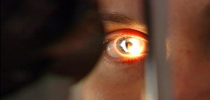 В США нашли аденовирус, поражающего почки и легкие и страшнее COVID-19