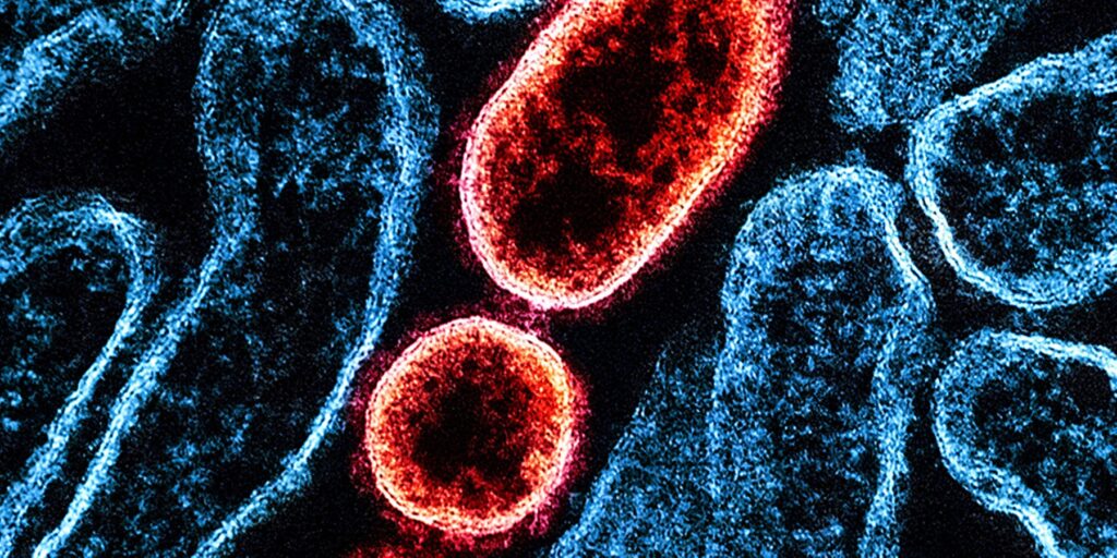 Китайский препарат от COVID-19 показал эффективность против смертельного вируса Нипах Китайский препарат от COVID-19 показал эффективность против смертельного вируса Нипах