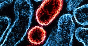 Китайский препарат от COVID-19 показал эффективность против смертельного вируса Нипах