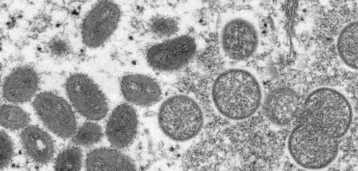 Минздрав РФ опроверг слухи о пандемии опасного аденовируса