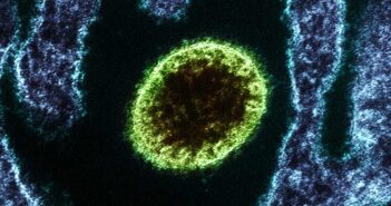 В Индии зафиксирована вспышка смертельного вируса Нипах с летальностью до 75%