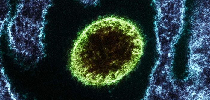 В Индии зафиксирована вспышка смертельного вируса Нипах с летальностью до 75%