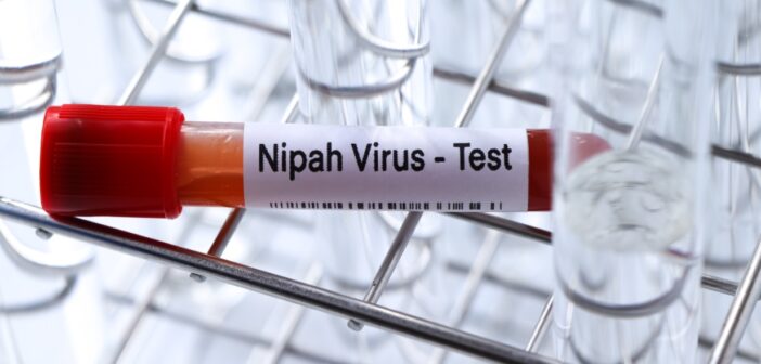 ВОЗ оценила угрозу глобальной пандемии вируса Нипах