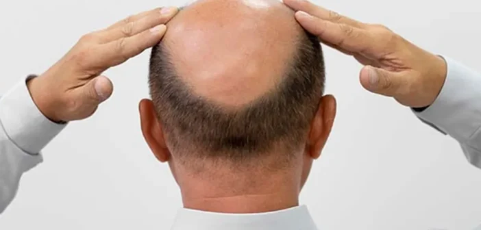 Японские ученые нашли клетку для бесконечного роста волос