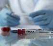 ВОЗ признала вспышку Эболы чрезвычайной ситуацией