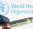 В Европе начались карантинные мероприятия из-за вспышки хантавируса