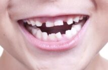 В Японии начались клинические испытания препарата для выращивания зубов